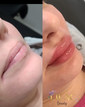 lip blush service westmount on